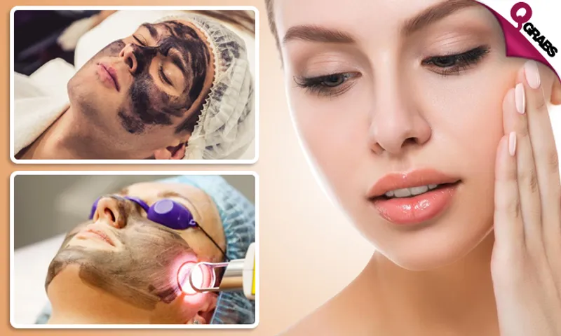Carbon Laser Treatment!